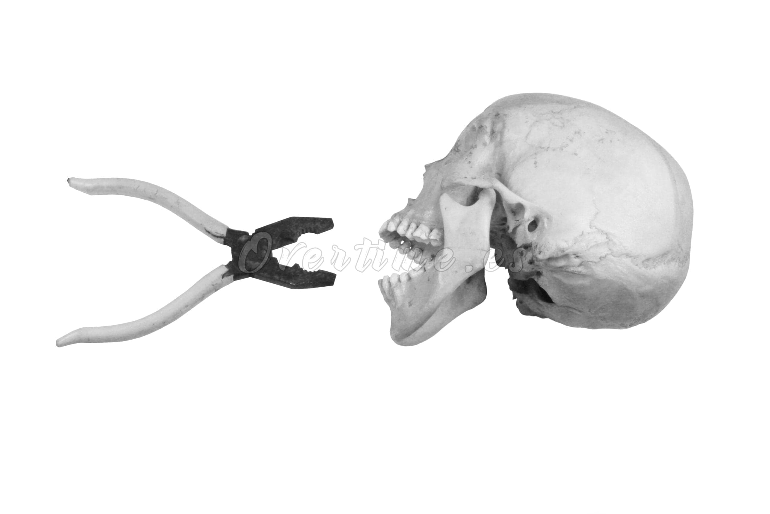 Fotografía "Agresión"